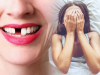 Mơ thấy rụng răng là điềm báo gì? Nên đánh số mấy dễ về?